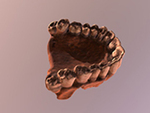 Le Moustier maxilla fragment (Homo sapiens neanderthalensis)
